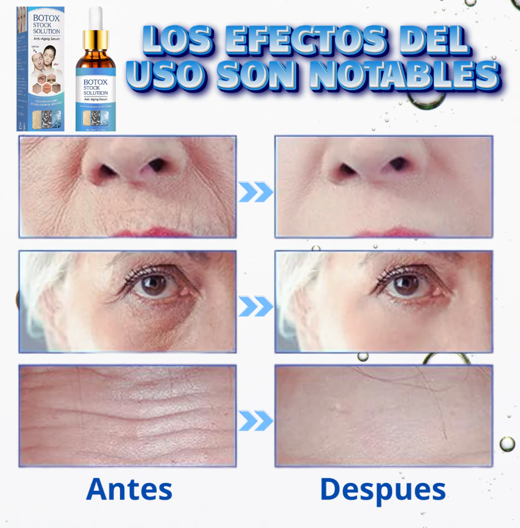 Tu piel más lisa y juvenil sin agujas ni dolor con el suero antiarrugas